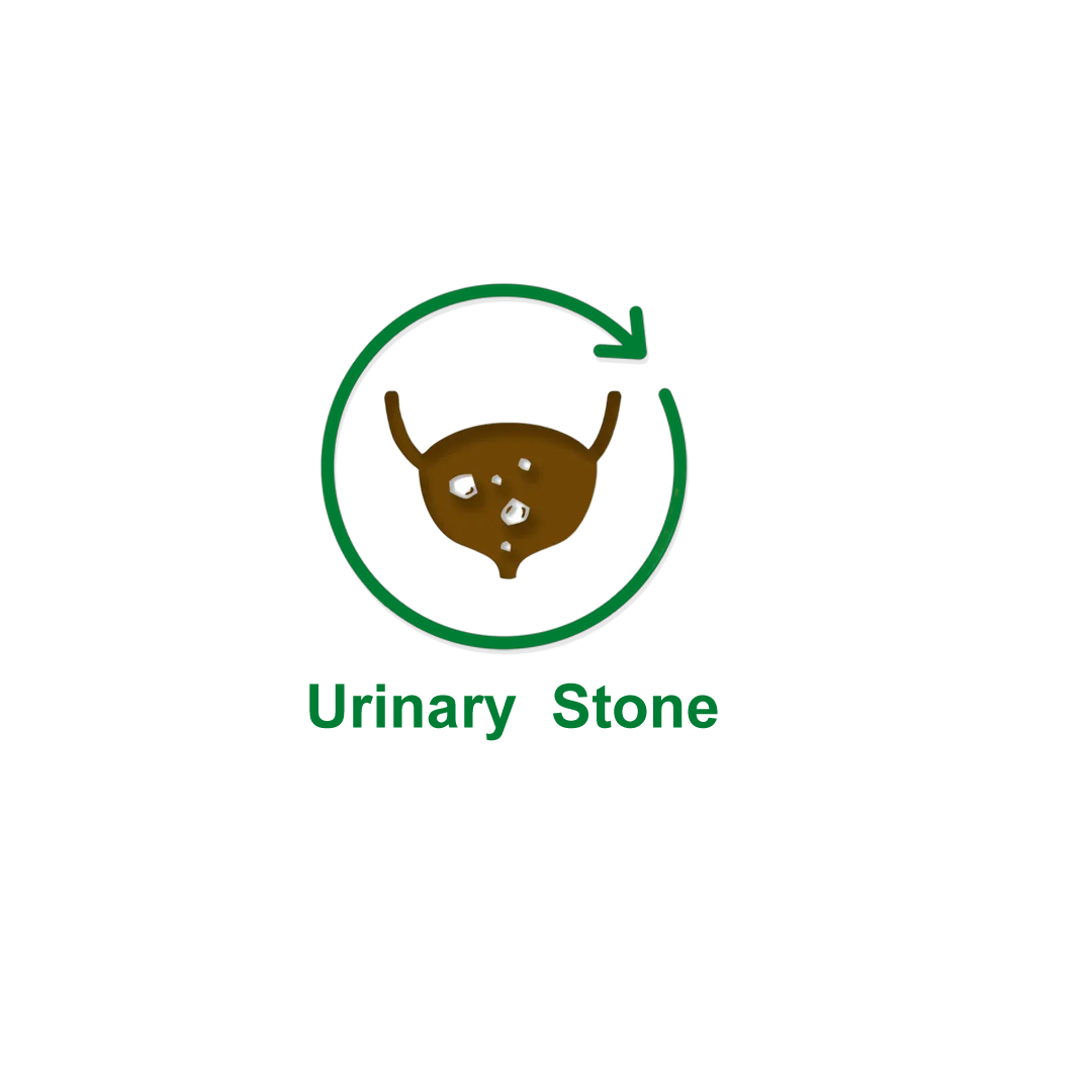 unriany stone